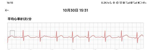 可以测血压的智能手表哪个品牌最好？-第9张图片